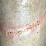 Thumbnail of 