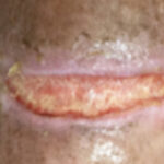 Thumbnail of 